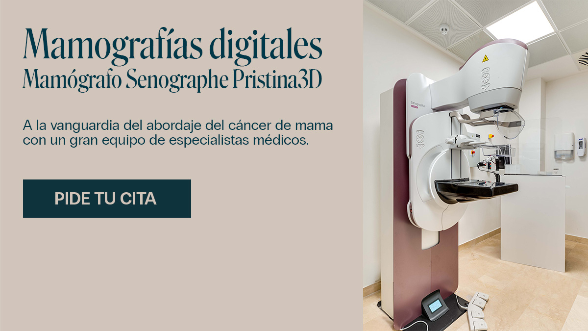 CTA_Mamografo-1200x680 (1)